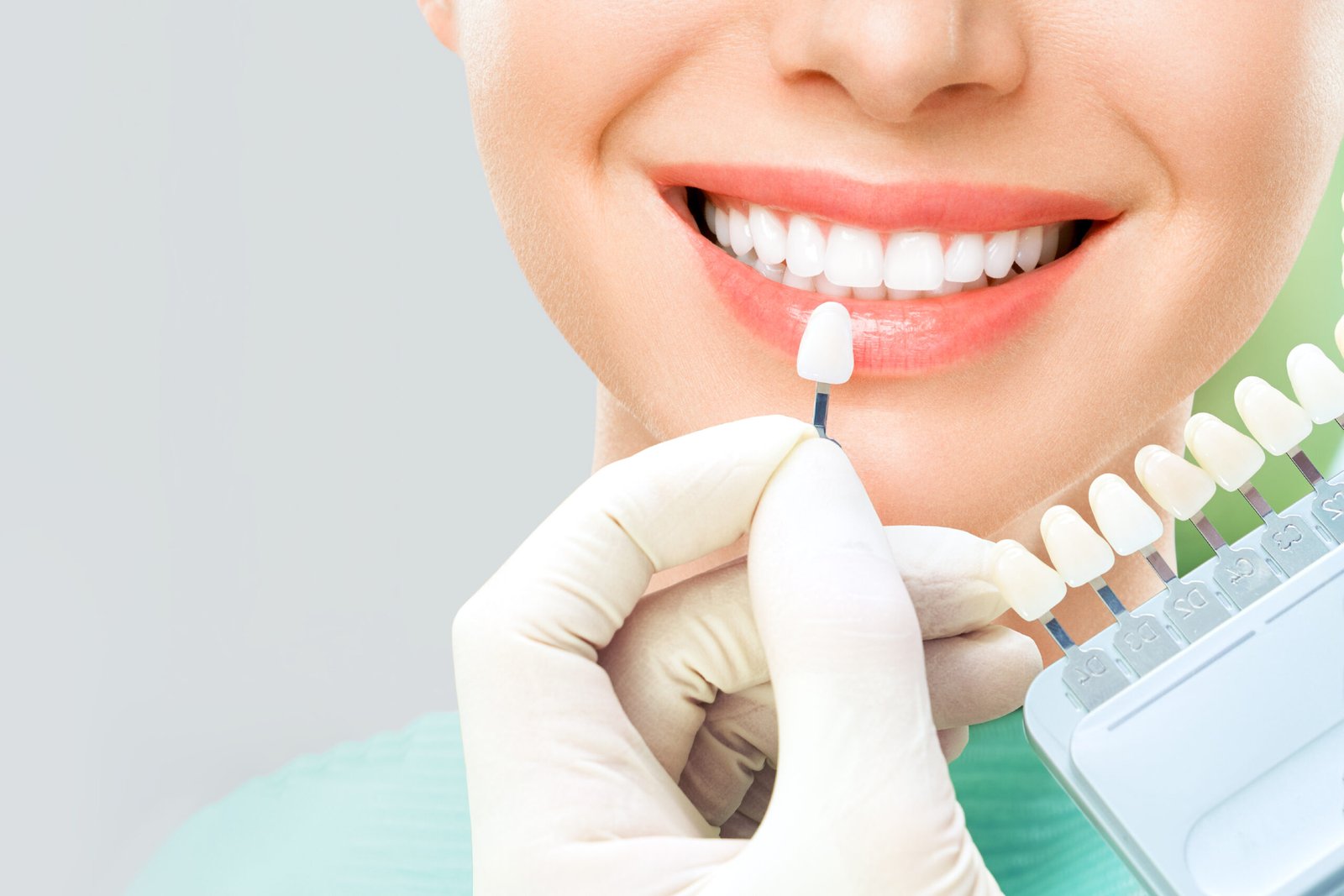 verifique-seleccione-color-dientes-blanqueamiento-dientes-scaled.jpg