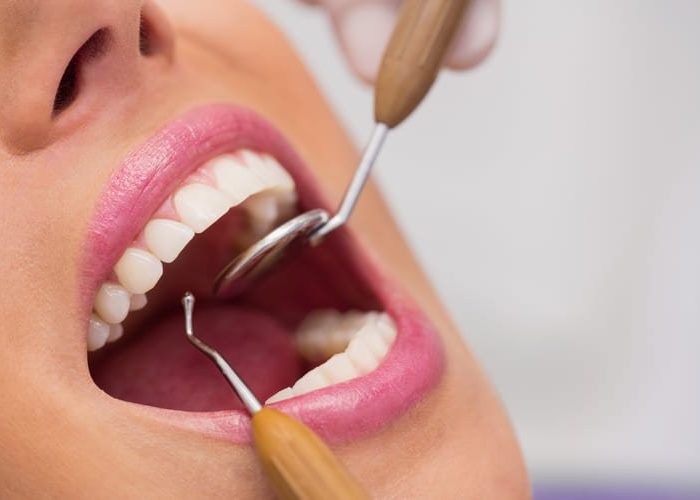 dentista-examinando-dientes-paciente-femenino-1.jpg