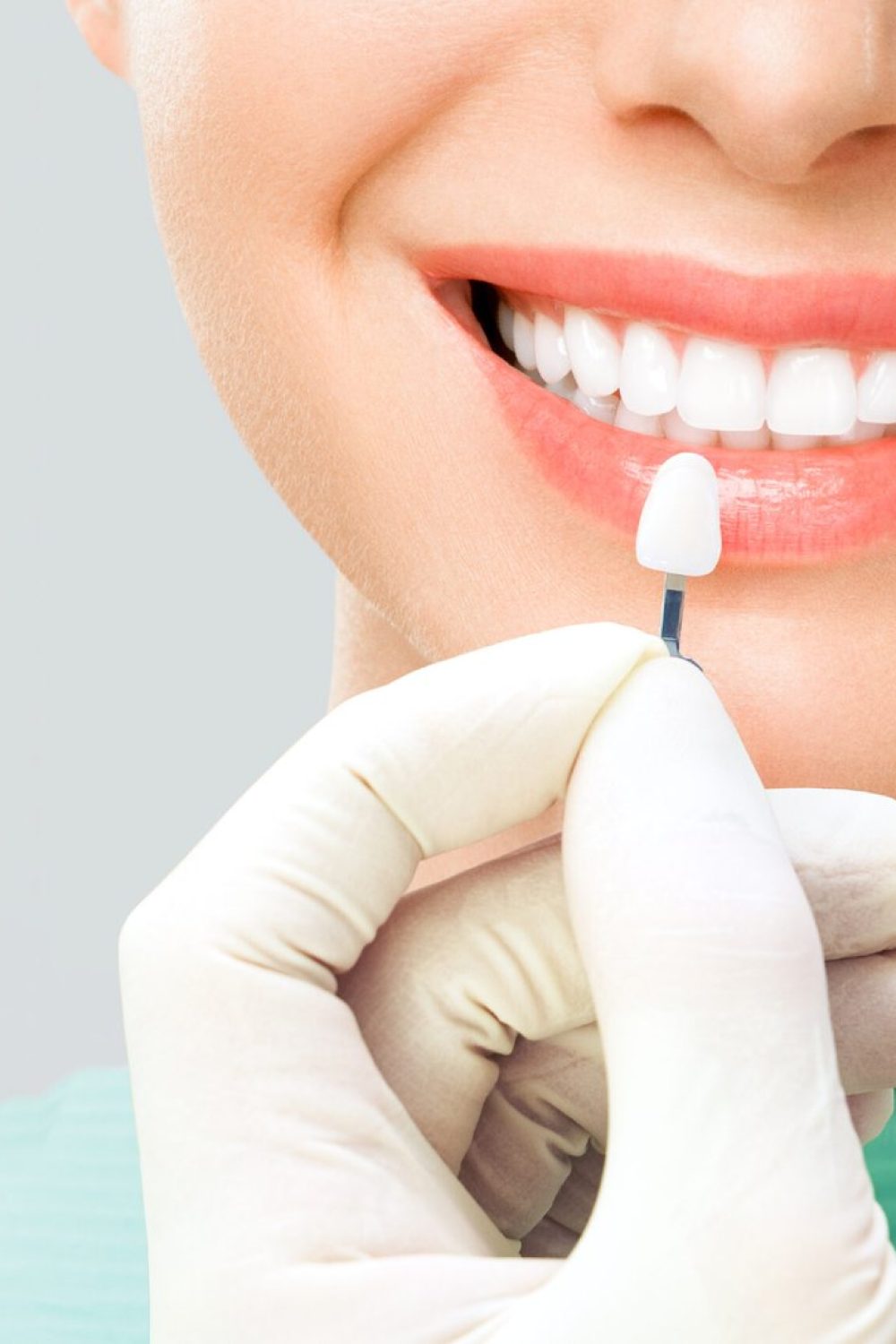 verifique-seleccione-color-dientes-blanqueamiento-dientes-scaled-1.jpg